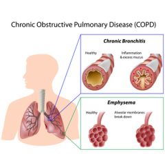RESP010 - Intervention and Strategies for the COPD Population
