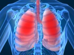 DMGT016 - Overview of Cystic Fibrosis