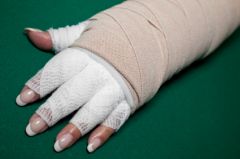 PEC020  Introduction to Lymphedema Products